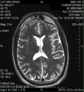 brain-scan-1